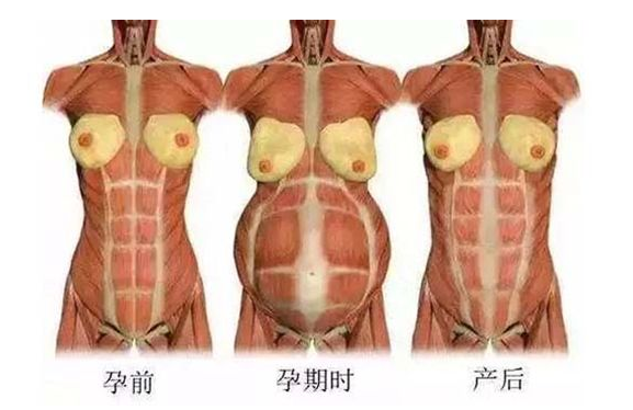 產(chǎn)后媽媽骨盆修復(fù)――帶你回到完美身材！