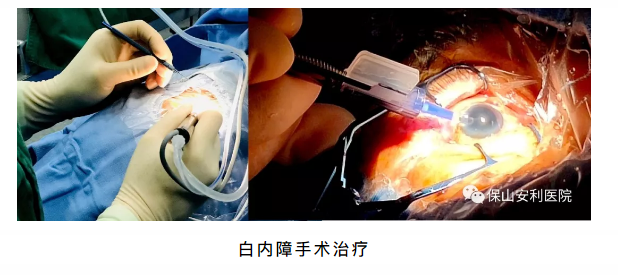 相約星期六，省級眼科、心內(nèi)科專家到院坐診、開展手術(shù)治療