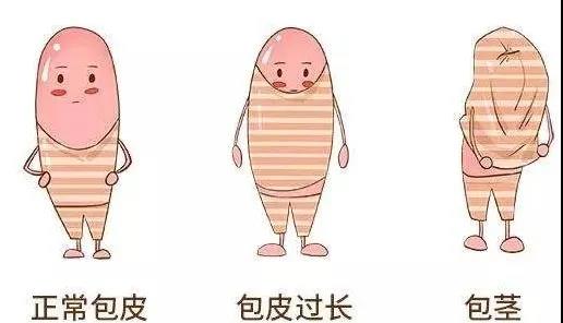 【保山安利醫(yī)院】家長速看！暑期包皮手術預約正當時！